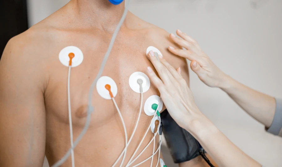 ECG Electrode for Chest Placement ECG Electrode for Chest Placement